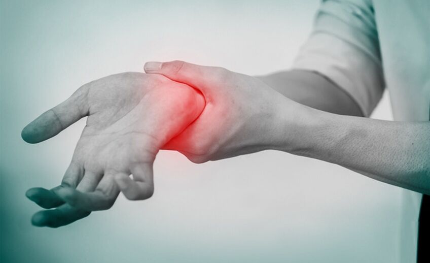 ból z artrozą stawu nadgarstkowego