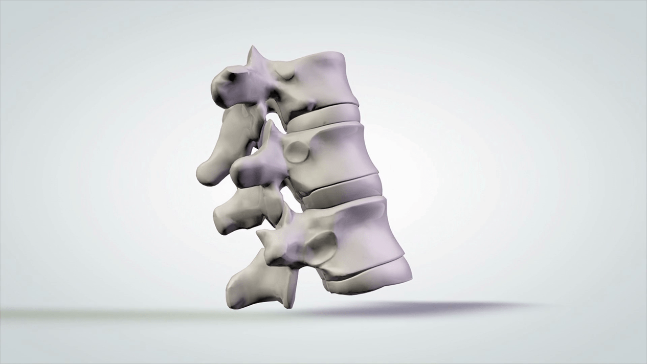 uraz kręgosłupa w osteochondrozie szyjnej